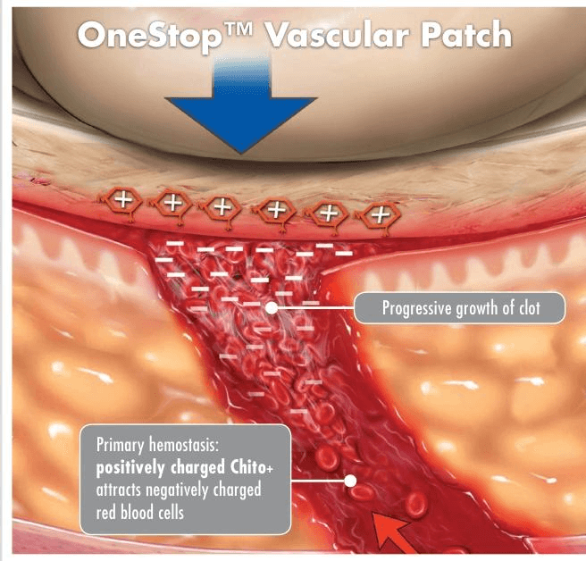 OneStop Vascular Technology